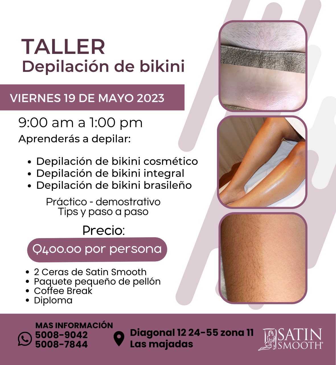 Taller Depilación Área Bikini Guatemala